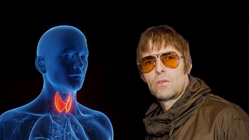 Liam Gallagher has been very open in discussing his longstanding thyroid problem. (Image: Getty)