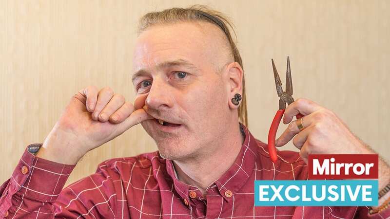 Agonised man unable to get NHS dentist rips out 5 of his own teeth using pliers
