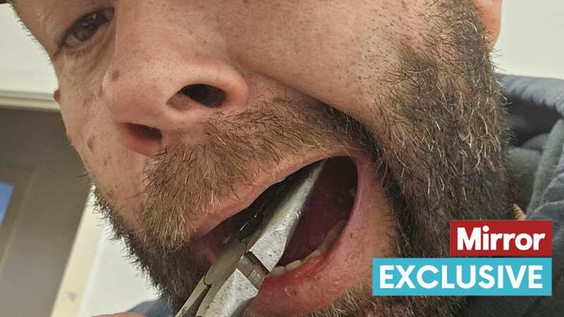 Chris Langston, 50, was left in excruciating pain for six months as he failed to get an NHS dentist appointment (Image: Chris Langston / SWNS)