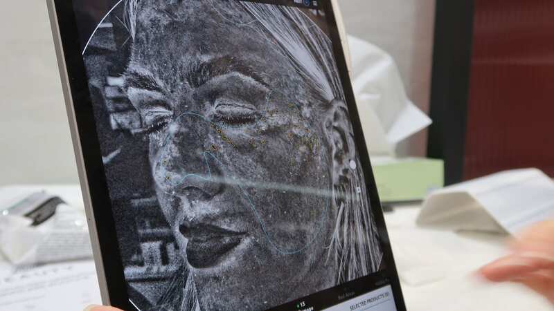 The skin scan can flag any areas affected by UV damage