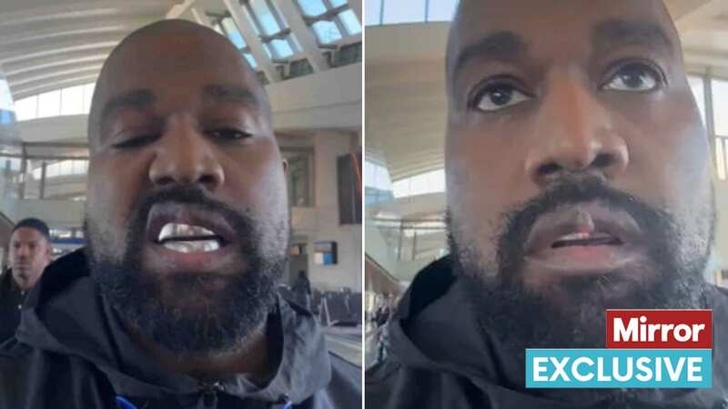 Kanye West has caused concern with his new dentures