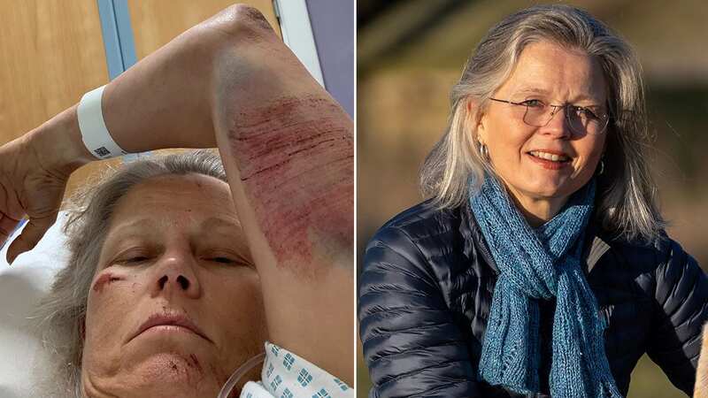 Janicke Tvedt was attacked by cows whilst out walking her dog (Image: Janicke Tvedt / SWNS)