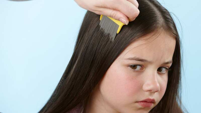 A health expert has warned that lice are more resilient to over-the-counter treatments (Image: Getty)