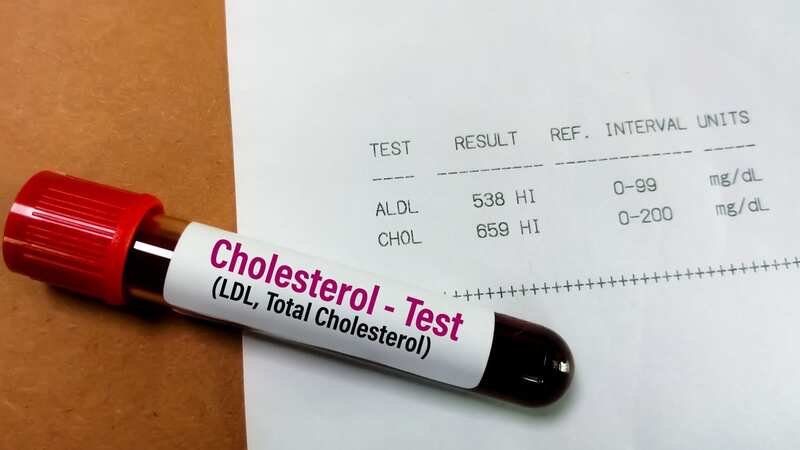 A blood sample is taken to measure cholesterol levels (Image: Getty Images)