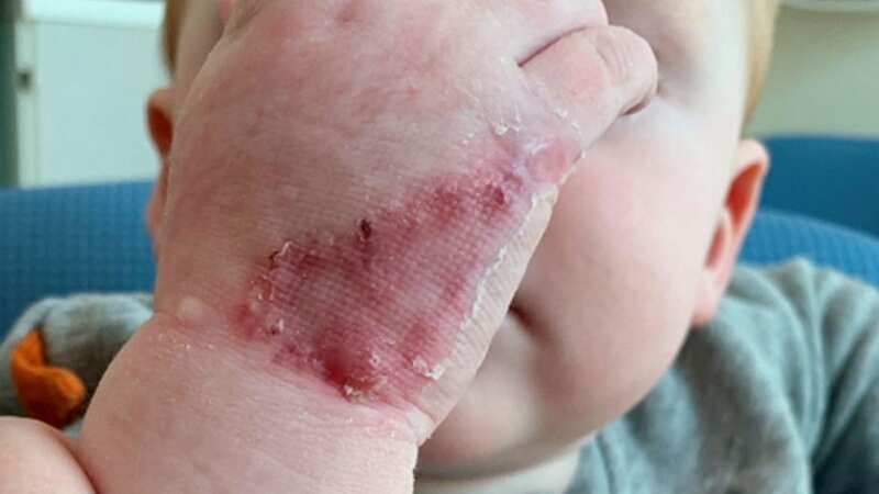 Billy, who was 14 months old at the time, grabbed hold of his mum