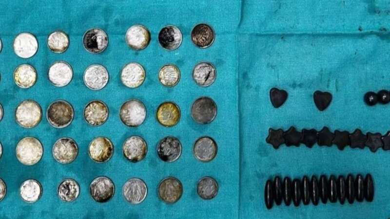 Docs find 39 coins and 37 magnets in man
