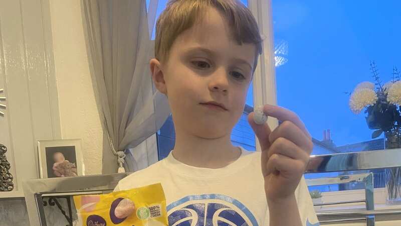 Jacob had a Mini Egg stuck in his throat (Image: KennedyNews/VickyHeavey)