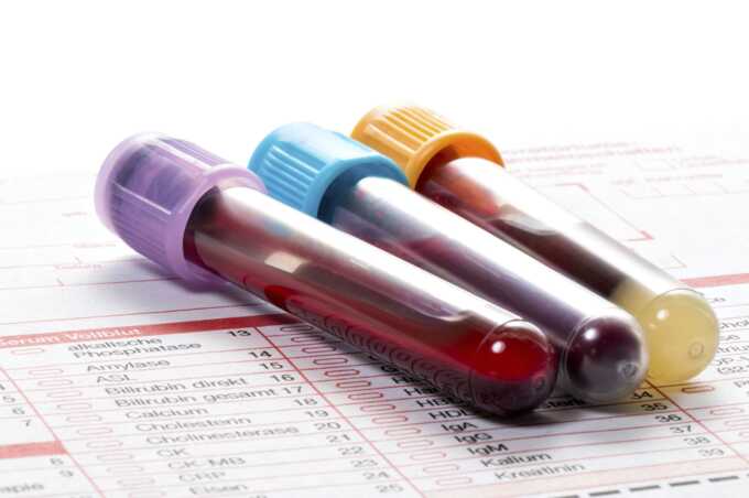 Government to fund £120 blood test aimed at detecting 12 common cancers