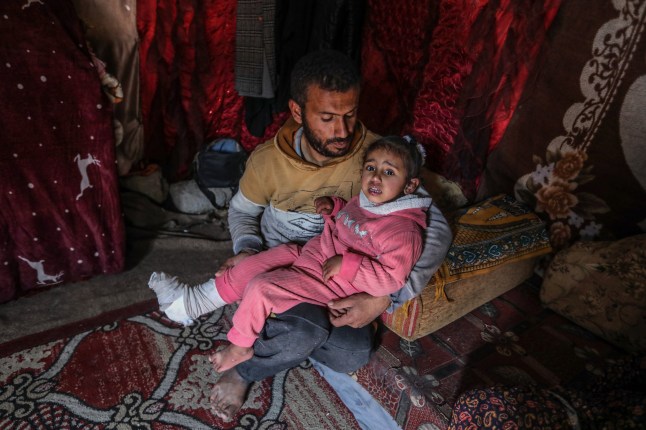 KHAN YUNIS, GAZA - JAN 14: Lian Abu Obeida, a 3-year-old Palestinian girl who was wounded in various parts of her body in the Israeli attacks on Gaza, is pictured in Khan Yunis, Gaza on January 14, 2025. Obeida is going through hard times due to lack of necessary treatment. Little Lian, who had a hole drilled in her neck and underwent surgery on her foot in order to breathe comfortably due to the wounds she received, is holding on to life with the help of her family in Khan Yunis city. (Photo by Abed Rahim Khatib/Anadolu via Getty Images)