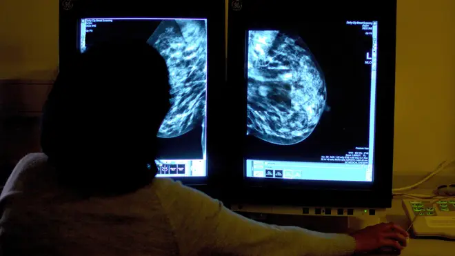 A consultant studying a mammogram. dqeiqeriqktidquinv eiqreidqkiqqdprw