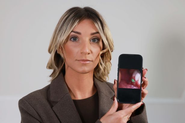 Katie Inglis holds up a mobile phone with an image of her gums post-surgery in 2022, with green mould embedded in them